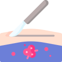 Cirurgia Oncológica